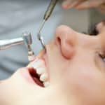 Dental Cleaning & Consultation
