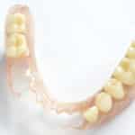 Removable Dentures