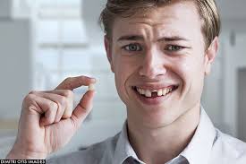 Broken tooth - front